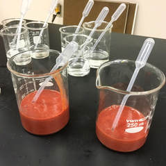 Teaching macromolecules: Liver enzyme lab