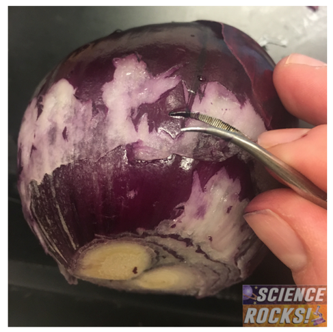 How to use onion skin for your osmosis microscope lab